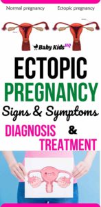 Ectopic Pregnancy: Signs & Symptoms, Diagnosis & Treatment - BabyKidsHQ